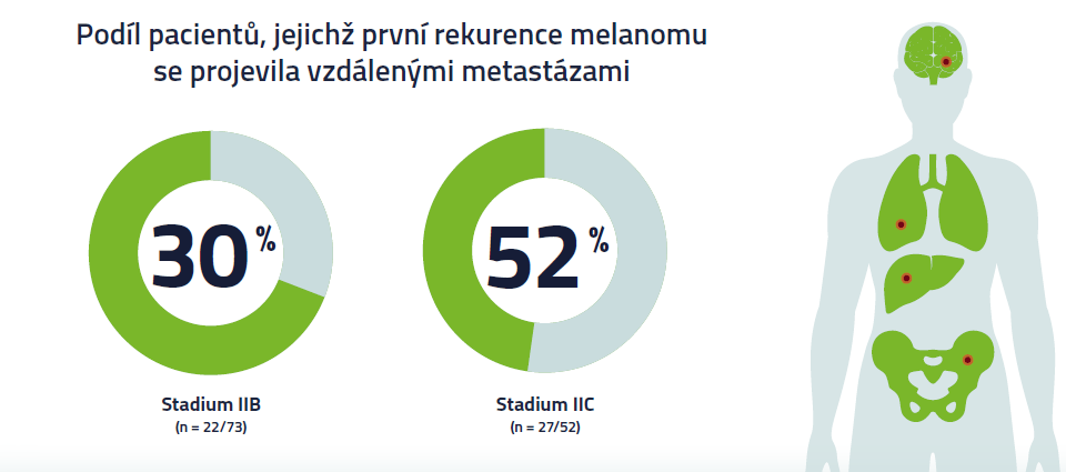 Podíl pacientů, jejichž první rekurence melanomu se projevila vzdálenými metastázemi